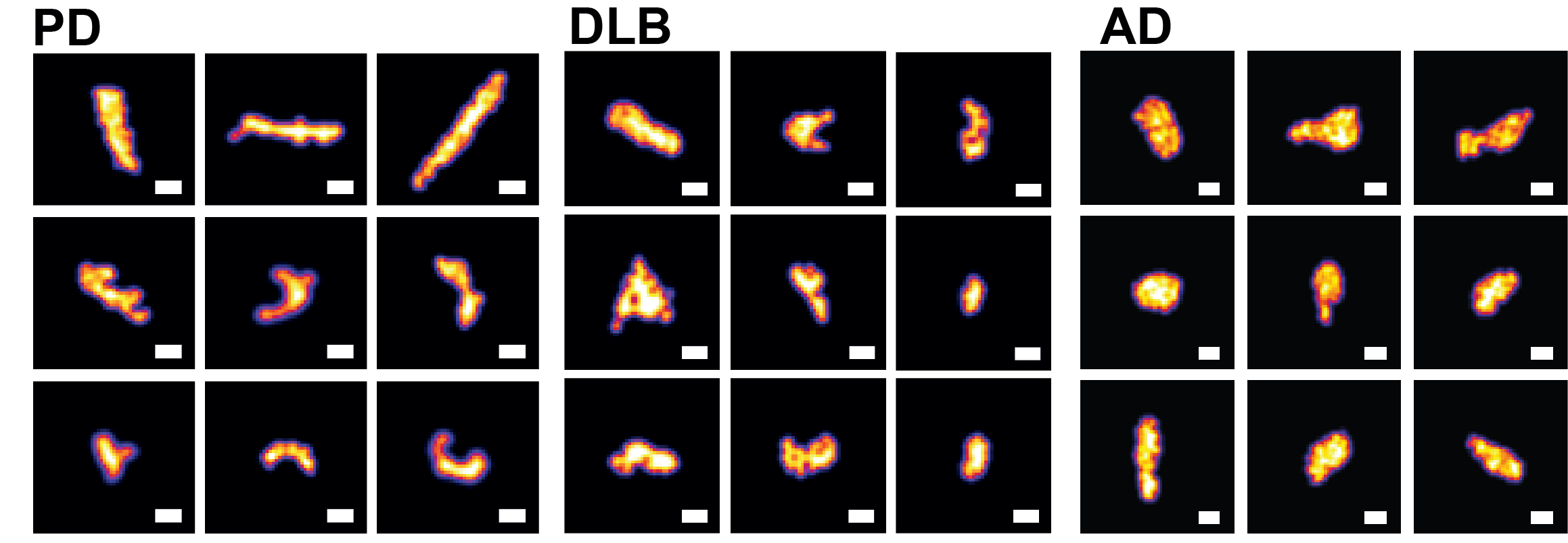 SMLM aggregates